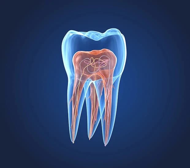 علاج خراج الأسنان